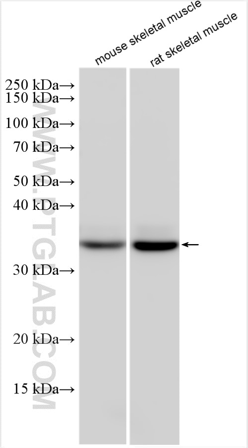 Western Blot (WB) analysis of various lysates using FBP2 Polyclonal antibody (25192-1-AP)