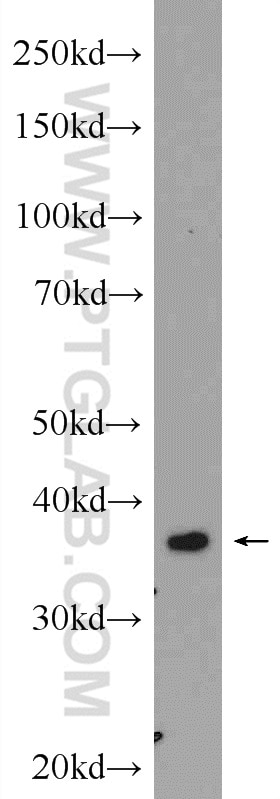Western Blot (WB) analysis of mouse skeletal muscle tissue using FBP2 Polyclonal antibody (25192-1-AP)