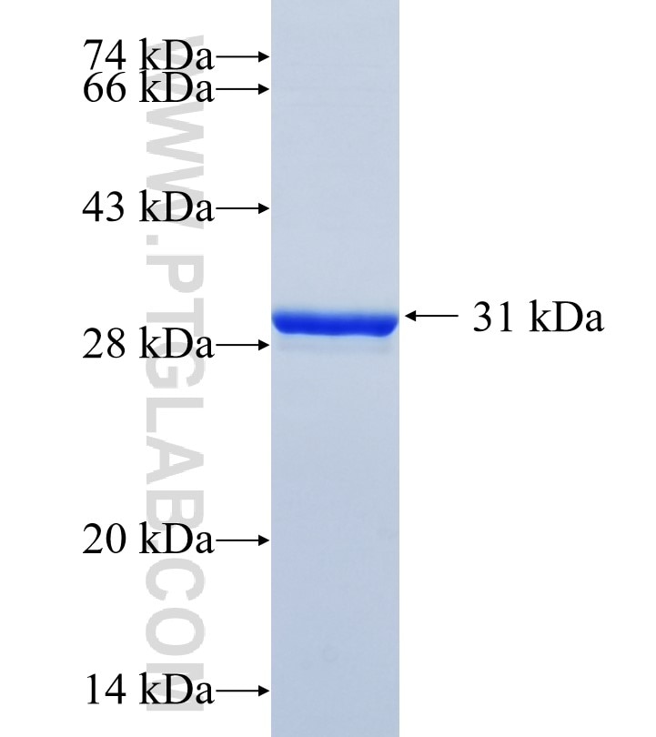 FBP2 fusion protein Ag18245 SDS-PAGE