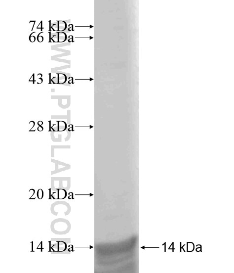 FBP2 fusion protein Ag18862 SDS-PAGE