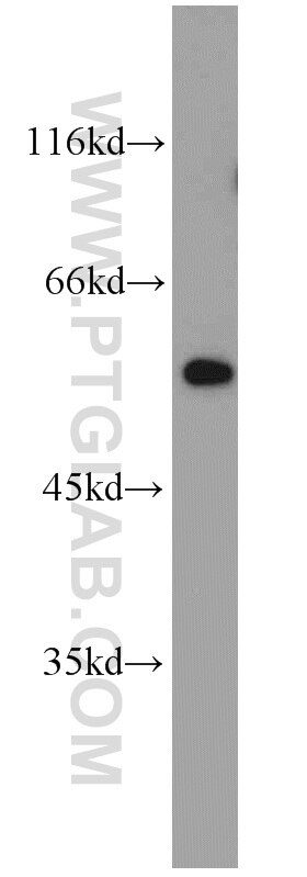 Western Blot (WB) analysis of Jurkat cells using fibrosin Polyclonal antibody (11356-1-AP)