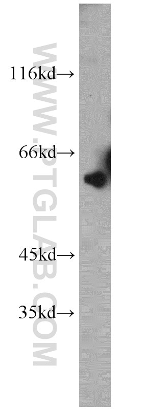 Western Blot (WB) analysis of mouse kidney tissue using fibrosin Polyclonal antibody (11356-1-AP)