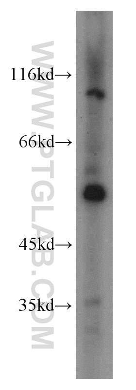 Western Blot (WB) analysis of MCF-7 cells using fibrosin Polyclonal antibody (11356-1-AP)