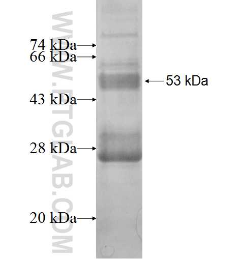 FBRS fusion protein Ag1870 SDS-PAGE