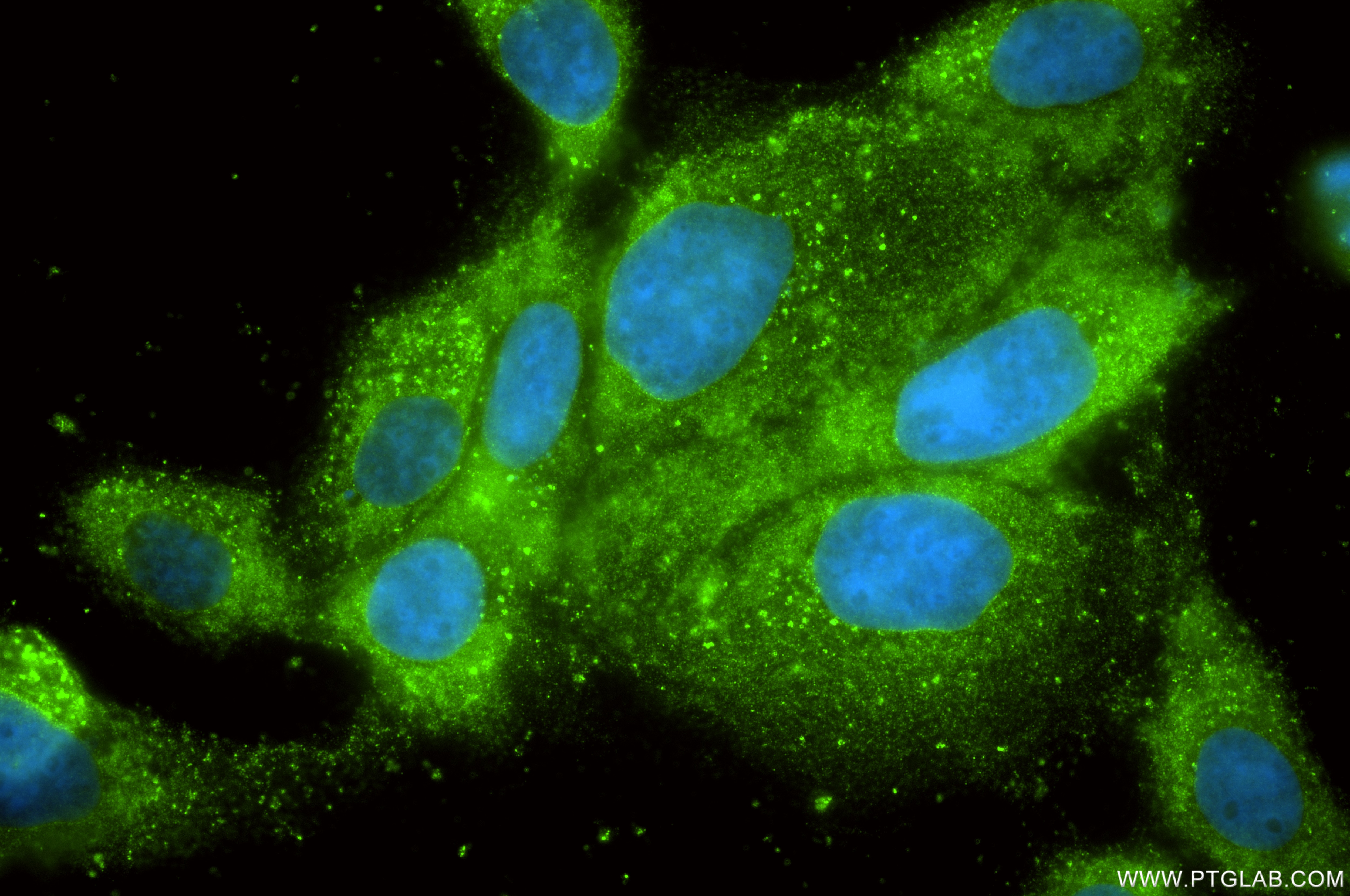 Immunofluorescence (IF) / fluorescent staining of A431 cells using FBX4 Recombinant monoclonal antibody (87549-1-RR)
