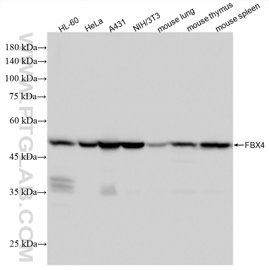 Western Blot (WB) analysis of various lysates using FBX4 Recombinant monoclonal antibody (87549-1-RR)