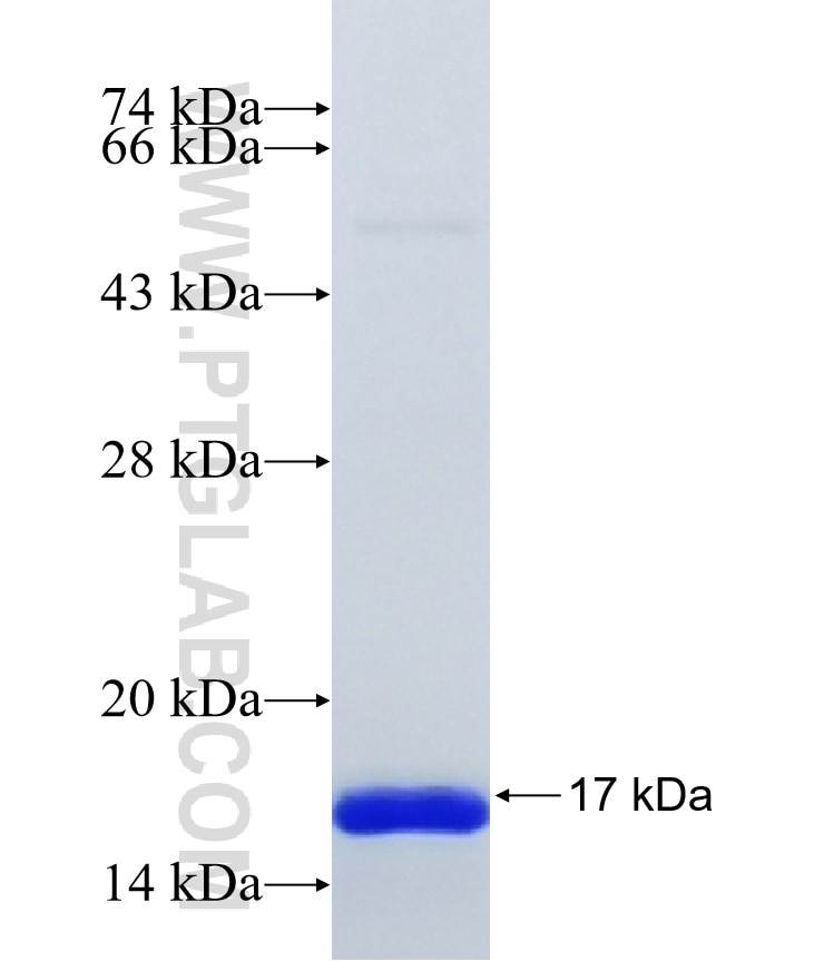 FBX43 fusion protein Ag40008 SDS-PAGE FBX43 fusion protein Ag40008 SDS-PAGE