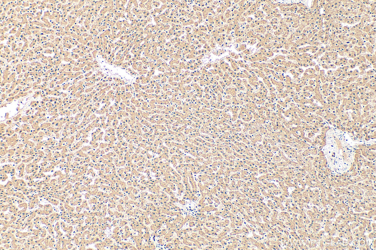 Immunohistochemistry (IHC) staining of human liver tissue using FBXL13 Polyclonal antibody (17139-1-AP)