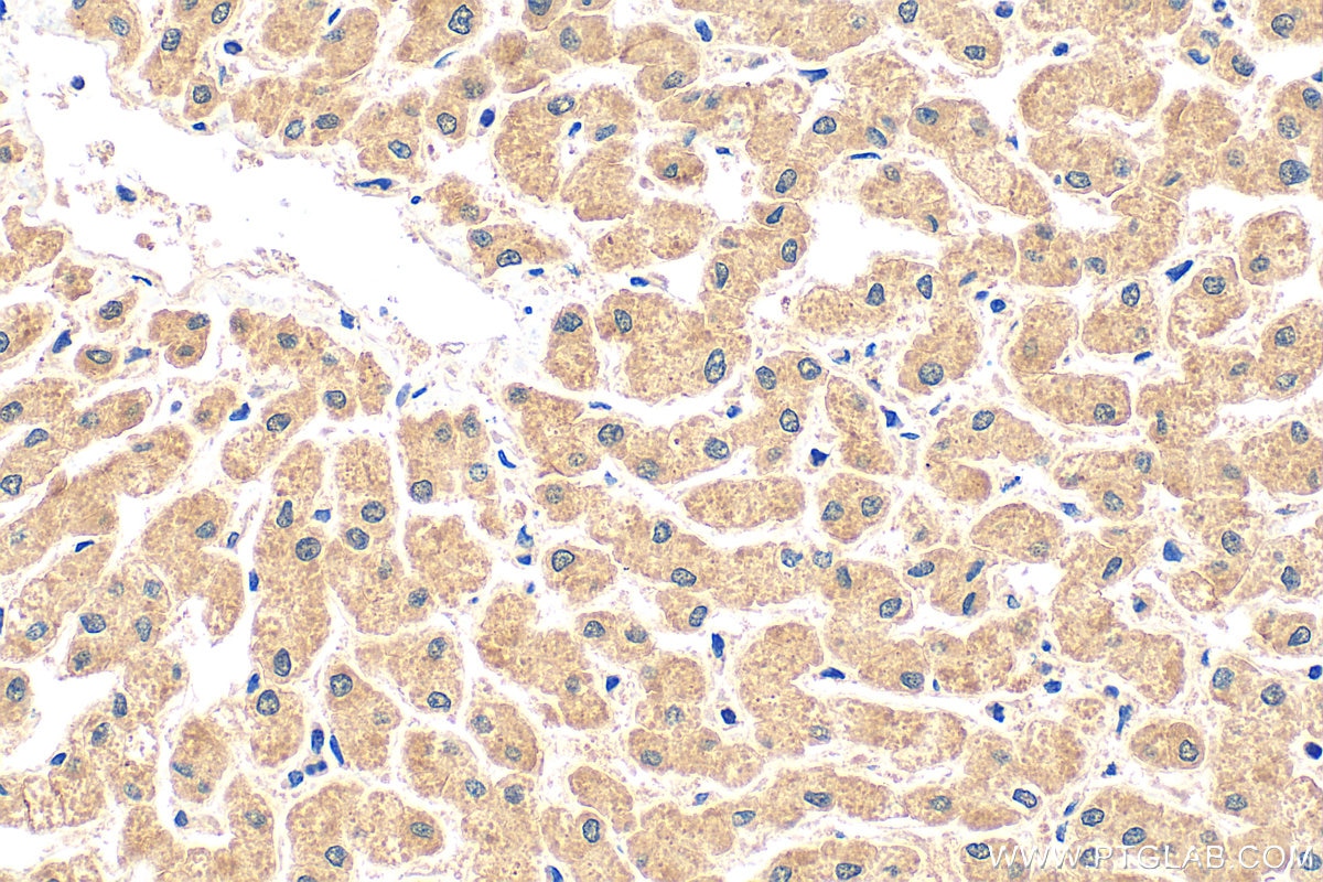 Immunohistochemistry (IHC) staining of human liver tissue using FBXL13 Polyclonal antibody (17139-1-AP)