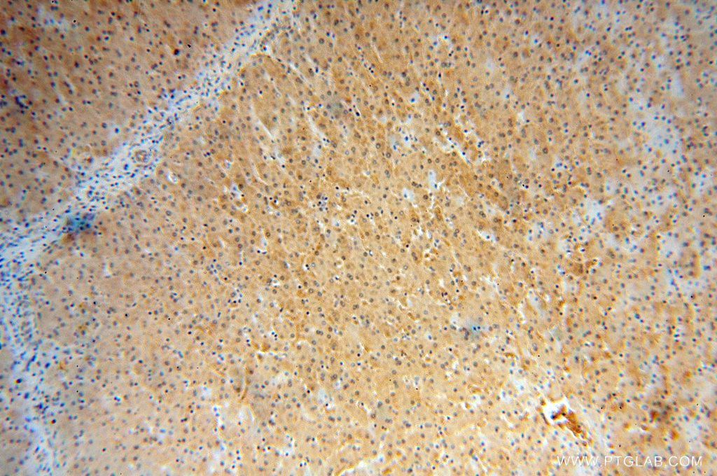Immunohistochemistry (IHC) staining of human liver tissue using FBXL13 Polyclonal antibody (17139-1-AP)
