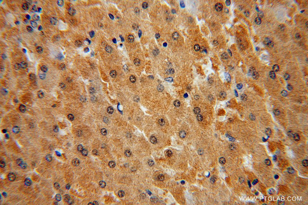 Immunohistochemistry (IHC) staining of human liver tissue using FBXL13 Polyclonal antibody (17139-1-AP)