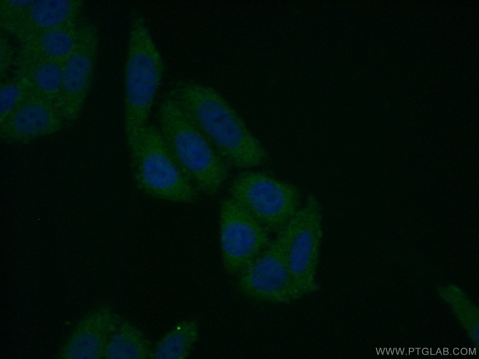 Immunofluorescence (IF) / fluorescent staining of HepG2 cells using FBXL14 Polyclonal antibody (13934-1-AP)