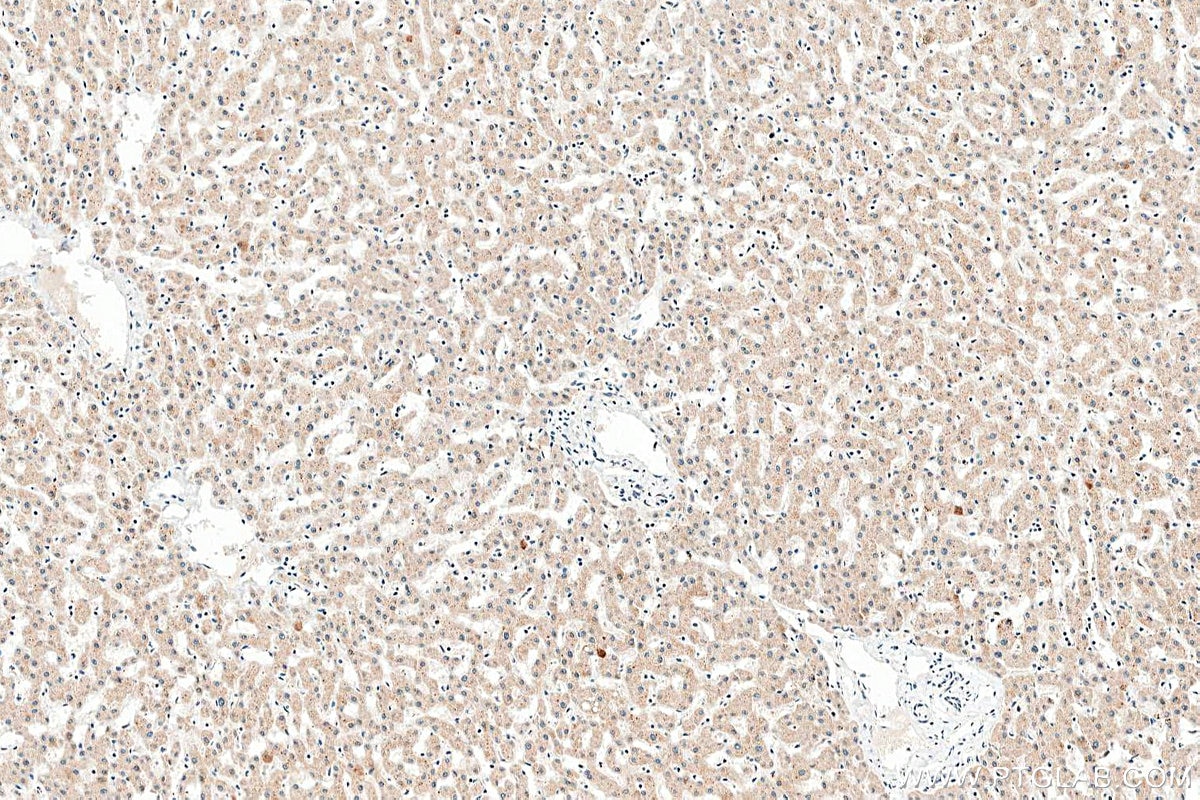 Immunohistochemistry (IHC) staining of human liver tissue using FBXL14 Polyclonal antibody (13934-1-AP)