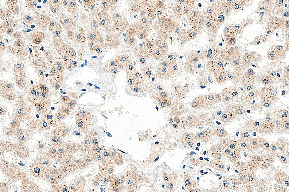 Immunohistochemistry (IHC) staining of human liver tissue using FBXL14 Polyclonal antibody (13934-1-AP)
