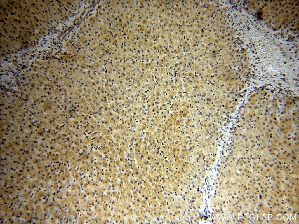 Immunohistochemistry (IHC) staining of human liver tissue using FBXL14 Polyclonal antibody (13934-1-AP)