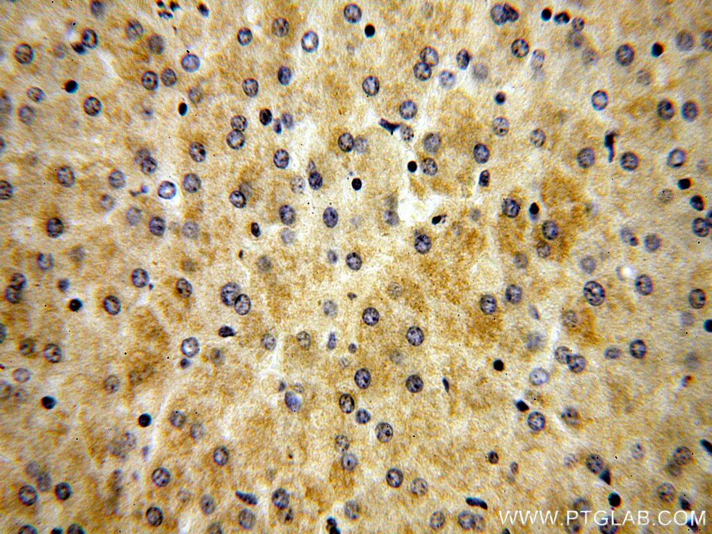 Immunohistochemistry (IHC) staining of human liver tissue using FBXL14 Polyclonal antibody (13934-1-AP)