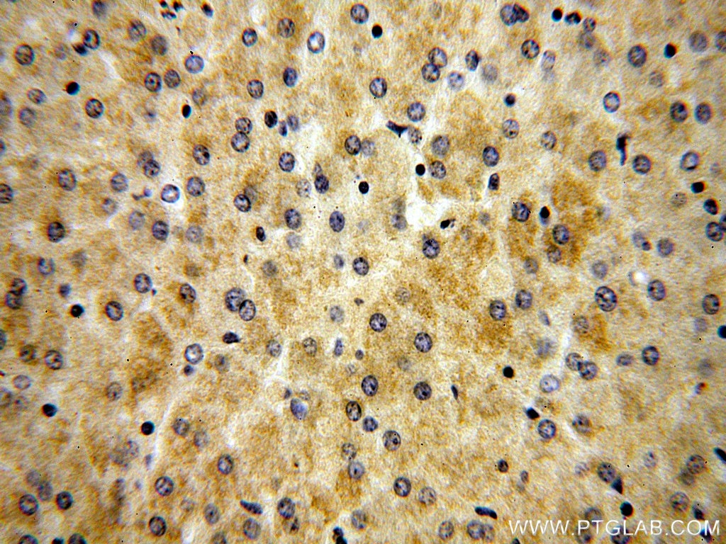 Immunohistochemistry (IHC) staining of human liver tissue using FBXL14 Polyclonal antibody (13934-1-AP)