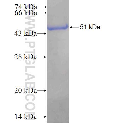 FBXL14 fusion protein Ag4975 SDS-PAGE
