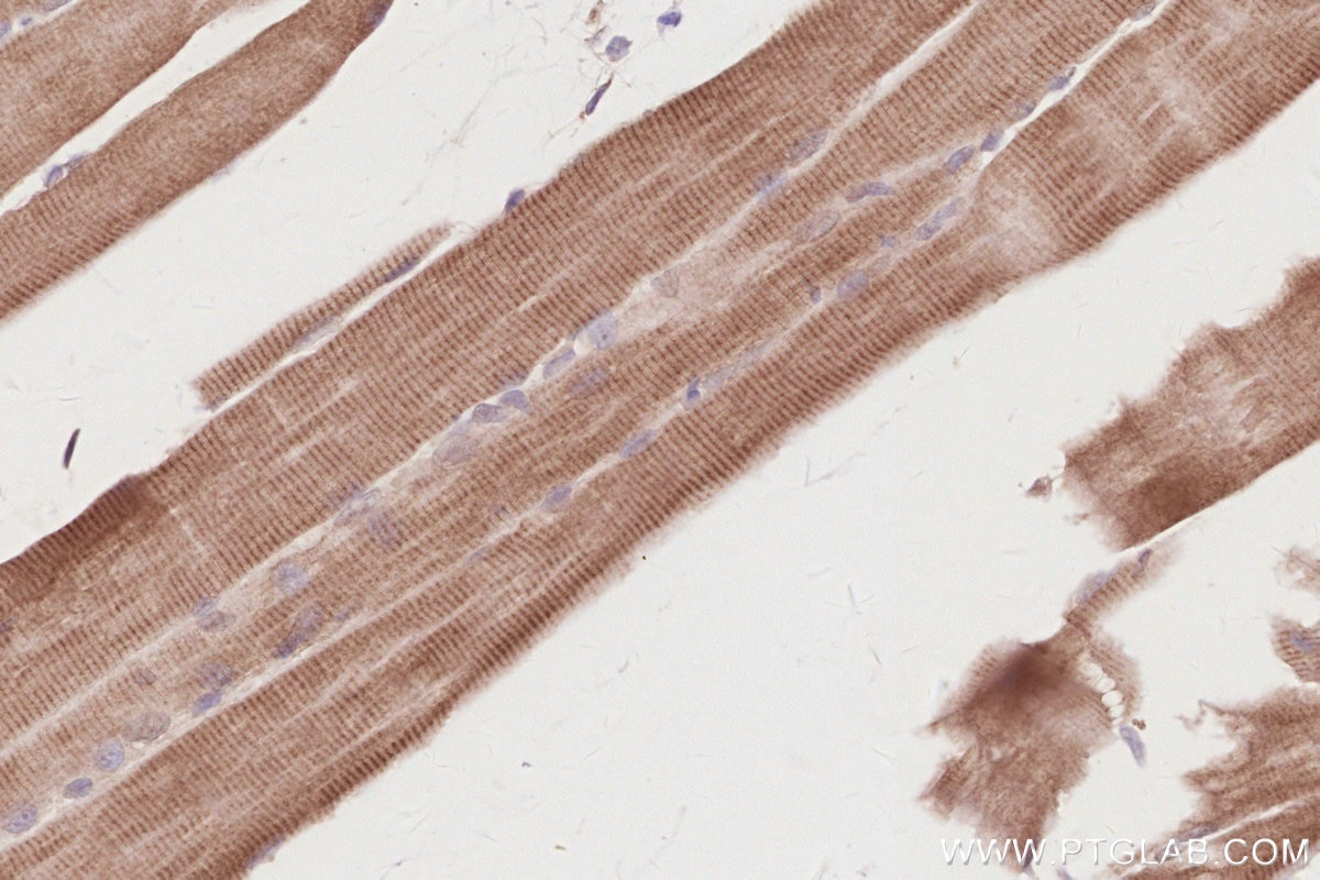 Immunohistochemistry (IHC) staining of mouse skeletal muscle tissue using FBXL15 Polyclonal antibody (20895-1-AP)