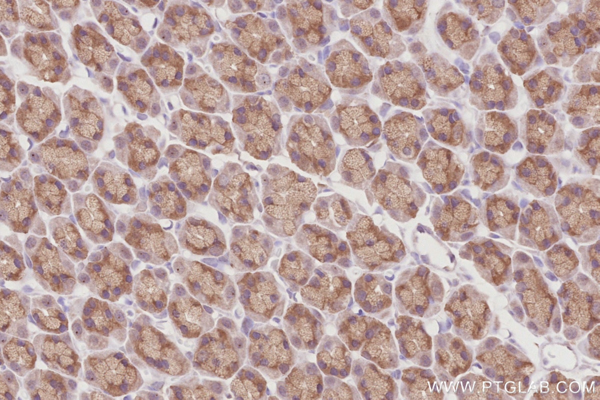 Immunohistochemistry (IHC) staining of rat stomach tissue using FBXL15 Polyclonal antibody (20895-1-AP)