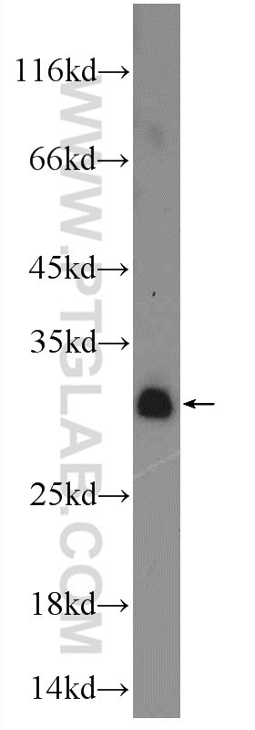 Western Blot (WB) analysis of MDA-MB-453s cells using FBXL15 Polyclonal antibody (20895-1-AP)