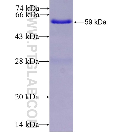 FBXL15 fusion protein Ag14949 SDS-PAGE