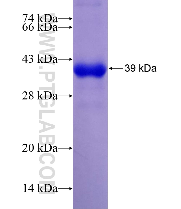 FBXL15 fusion protein Ag16972 SDS-PAGE