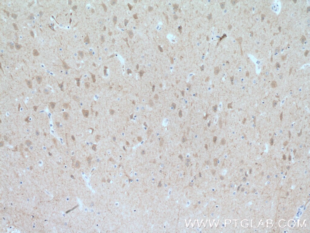 Immunohistochemistry (IHC) staining of human brain tissue using FBXL16 Polyclonal antibody (25950-1-AP)