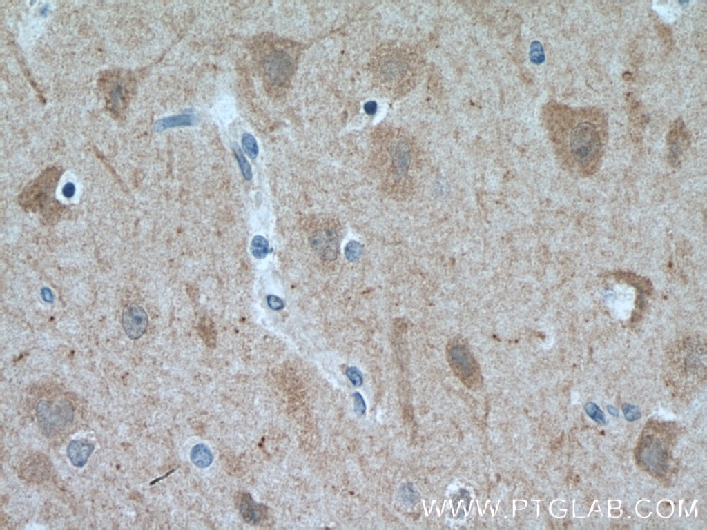 Immunohistochemistry (IHC) staining of human brain tissue using FBXL16 Polyclonal antibody (25950-1-AP)
