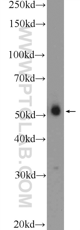 Western Blot (WB) analysis of HeLa cells using FBXL16 Polyclonal antibody (25950-1-AP)