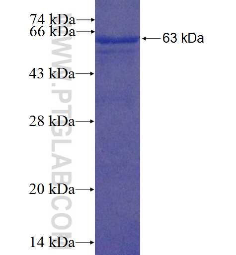 FBXL16 fusion protein Ag22827 SDS-PAGE