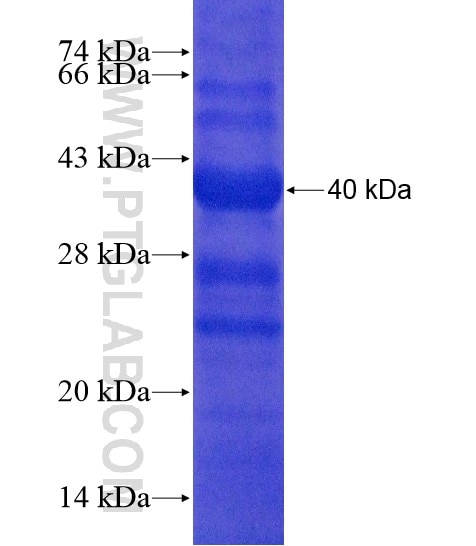 FBXL17 fusion protein Ag20436 SDS-PAGE