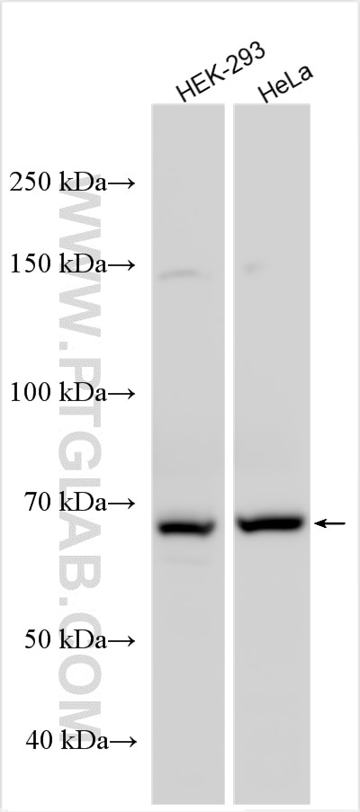 Western Blot (WB) analysis of various lysates using FBXL19 Polyclonal antibody (23624-1-AP)