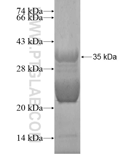FBXL19 fusion protein Ag20152 SDS-PAGE