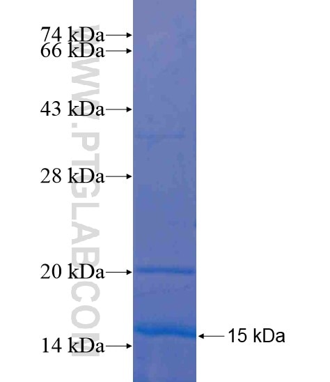 FBXL19 fusion protein Ag20198 SDS-PAGE