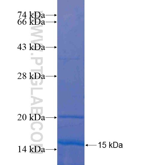 FBXL19 fusion protein Ag20198 SDS-PAGE