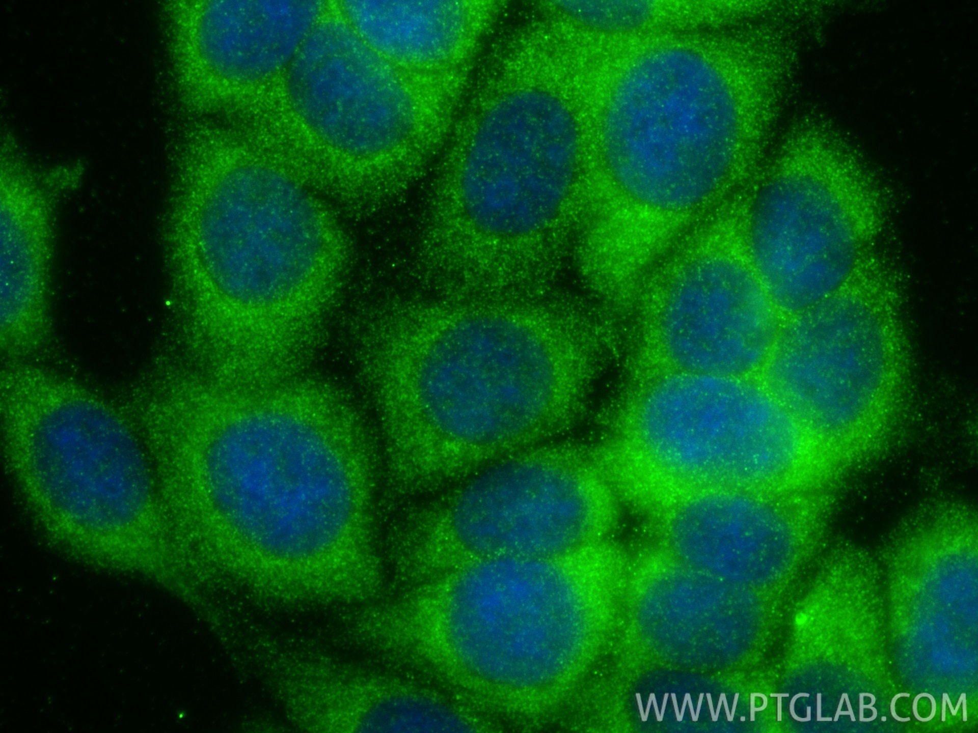Immunofluorescence (IF) / fluorescent staining of MCF-7 cells using FBXL20 Polyclonal antibody (20949-1-AP)