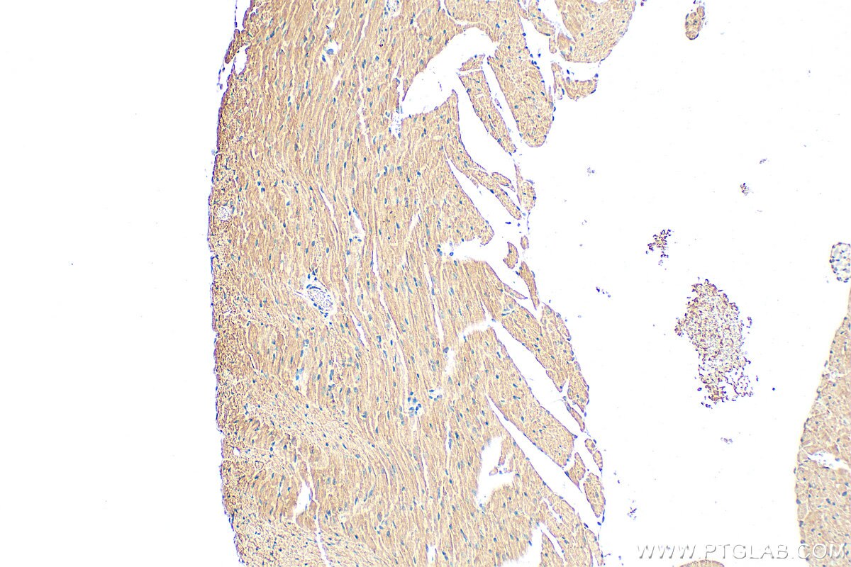 Immunohistochemistry (IHC) staining of mouse heart tissue using FBXL21 Polyclonal antibody (21437-1-AP)