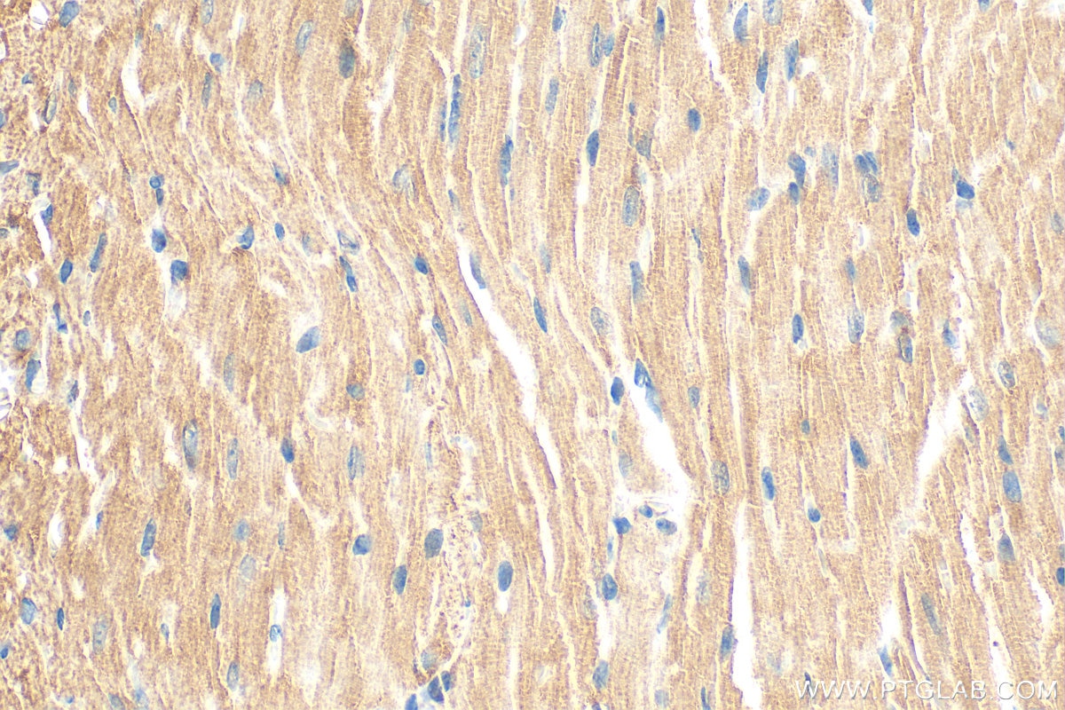 Immunohistochemistry (IHC) staining of mouse heart tissue using FBXL21 Polyclonal antibody (21437-1-AP)