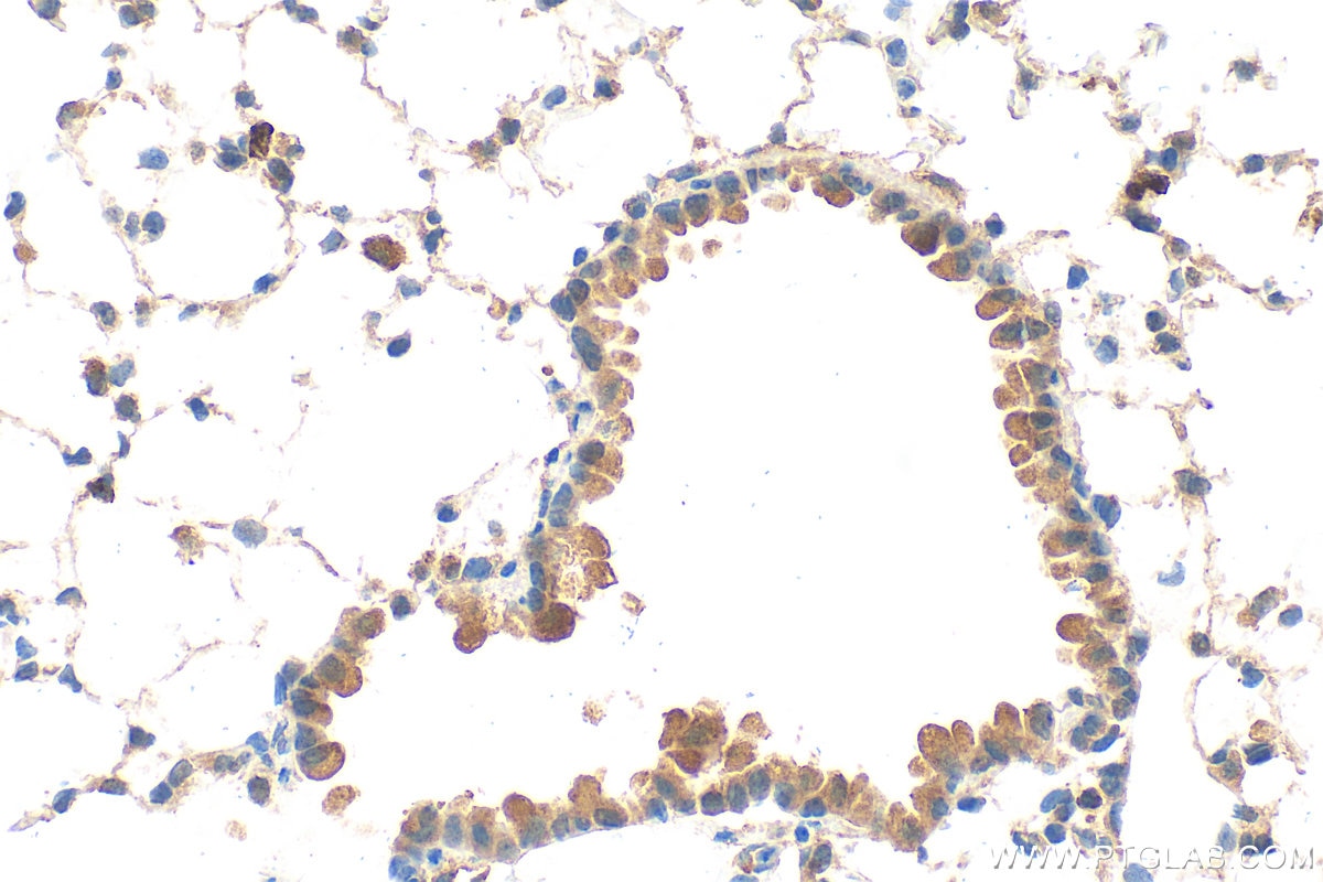 Immunohistochemistry (IHC) staining of mouse lung tissue using FBXL21 Polyclonal antibody (21437-1-AP)