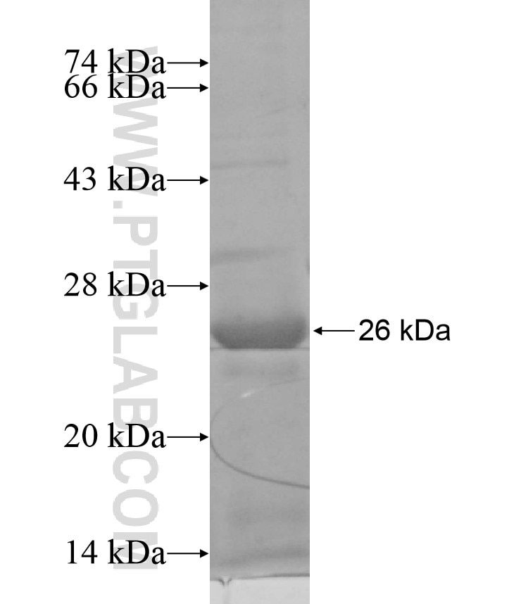 FBXL21 fusion protein Ag17343 SDS-PAGE