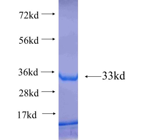 FBXL22 fusion protein Ag22426 SDS-PAGE