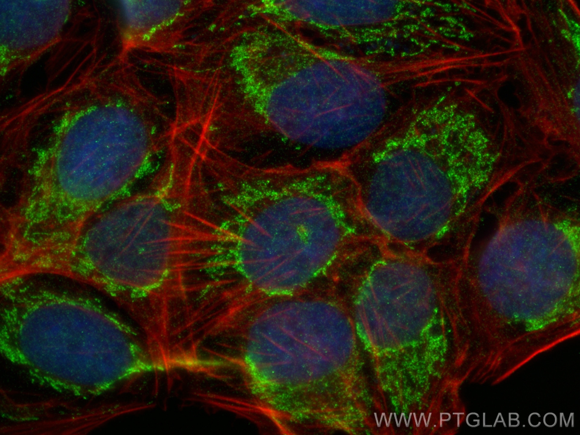 Immunofluorescence (IF) / fluorescent staining of U2OS cells using FBXL4 Polyclonal antibody (24754-1-AP)
