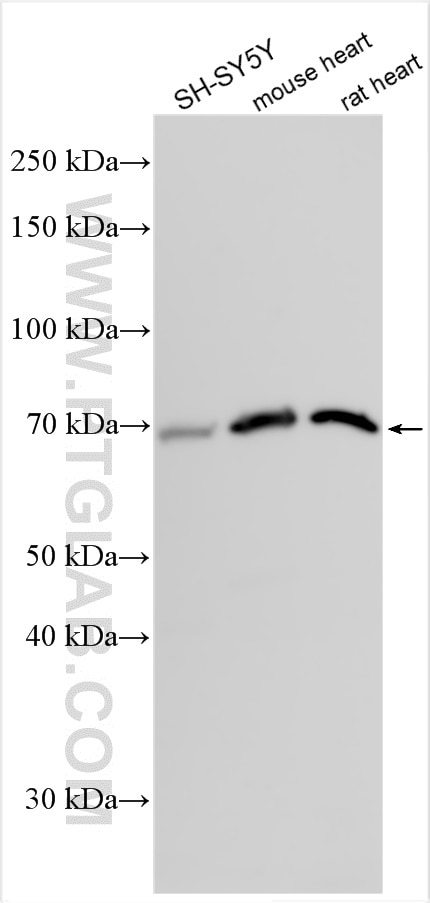 Western Blot (WB) analysis of various lysates using FBXL4 Polyclonal antibody (24754-1-AP)