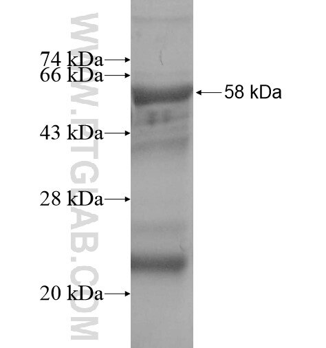 FBXL5 fusion protein Ag14101 SDS-PAGE