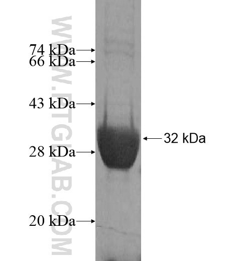 FBXL5 fusion protein Ag14497 SDS-PAGE