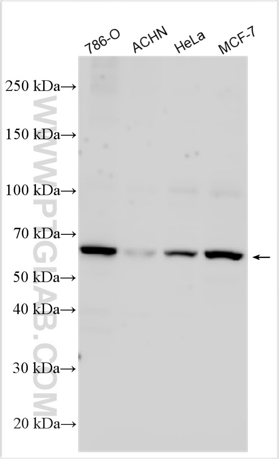 Various lysates were subjected to SDS PAGE followed by western blot with 33265-1-AP (FBXL6 antibody) at dilution of 1:1000 incubated at room temperature for 1.5 hours. Western Blot (WB) analysis of various lysates using FBXL6 Polyclonal antibody (33265-1-AP)