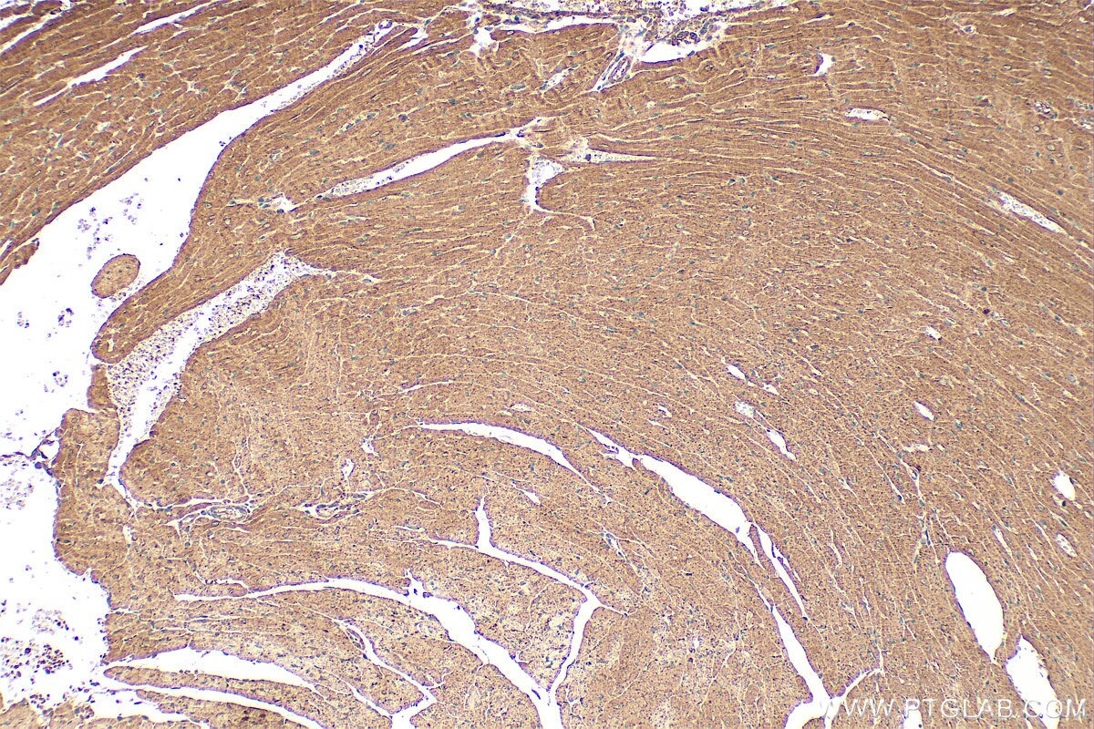Immunohistochemistry (IHC) staining of mouse heart tissue using FBXL8 Polyclonal antibody (16505-1-AP)