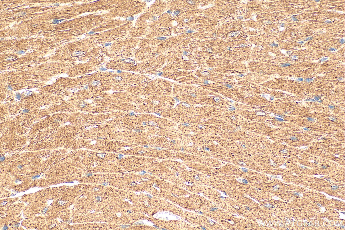 Immunohistochemistry (IHC) staining of mouse heart tissue using FBXL8 Polyclonal antibody (16505-1-AP)
