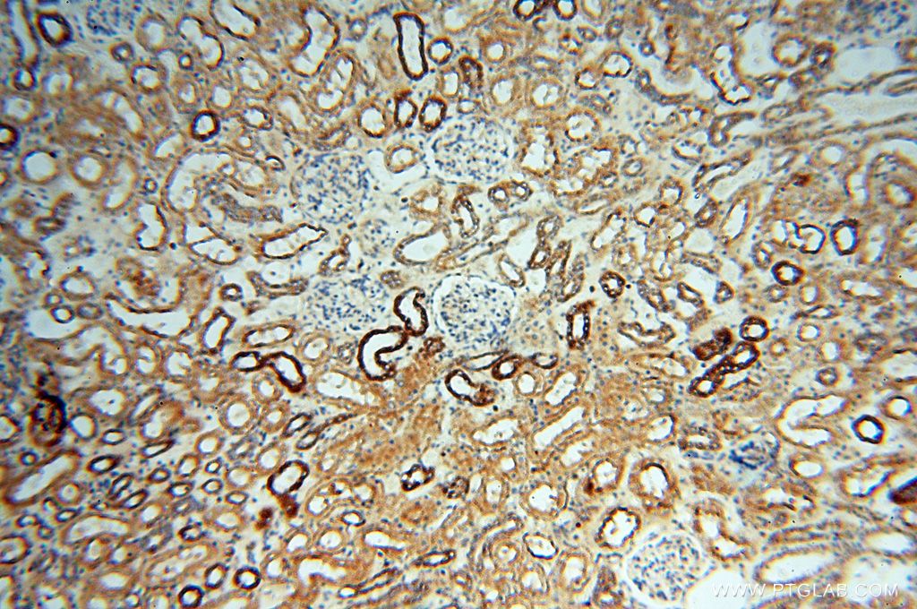 IHC staining of human kidney using 16505-1-AP